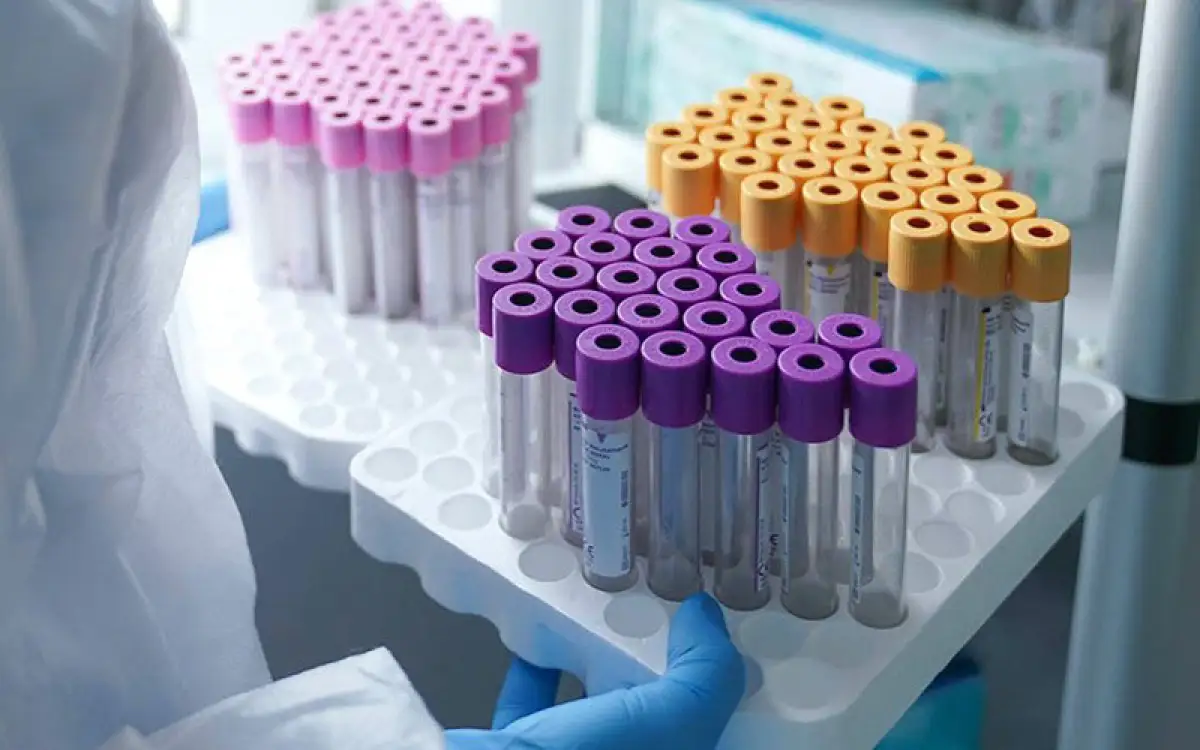 За сутки 465 казахстанцев заболели коронавирусом 