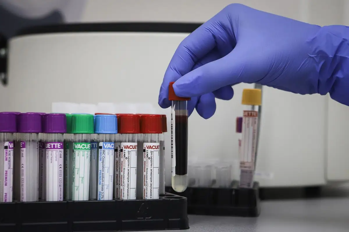 В Казахстане за сутки один скончался, 197 заболели коронавирусной пневмонией