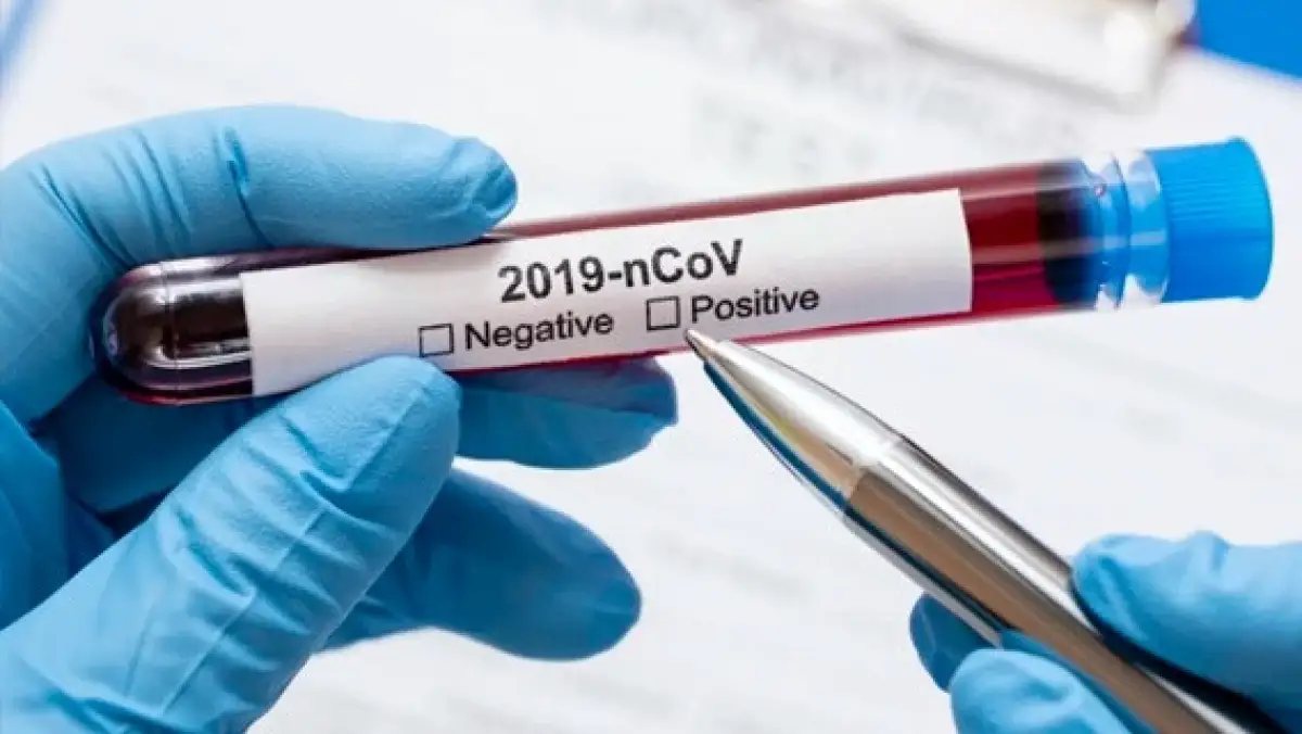 В Казахстане за сутки выявили 209 случаев коронавируса