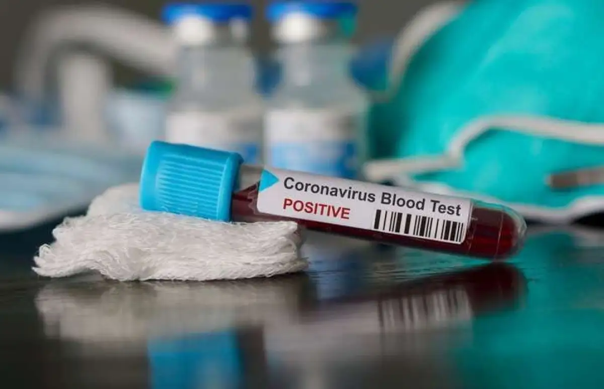 Сауле Кисикова: «Порядка 3000 жителей Нур-Султана уже прошли экспресс-тесты на коронавирус»