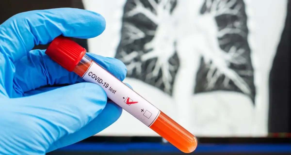 За ночь число зараженных COVID19 в Казахстане выросло до 961