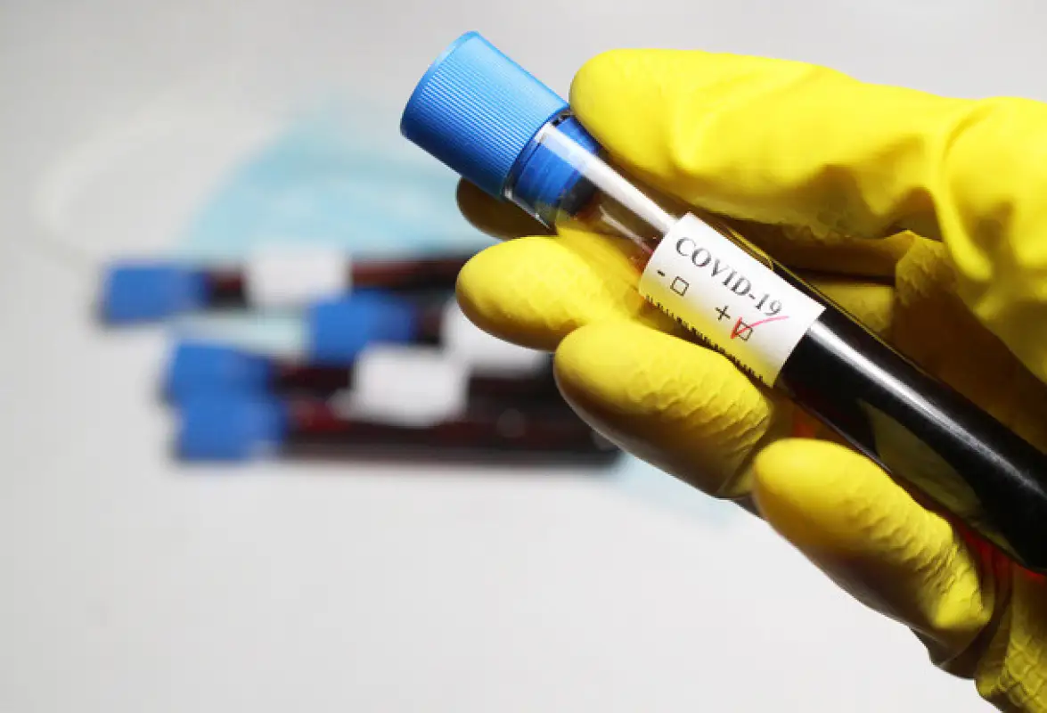 В Казахстане за сутки выявили 112 больных с коронавирусом