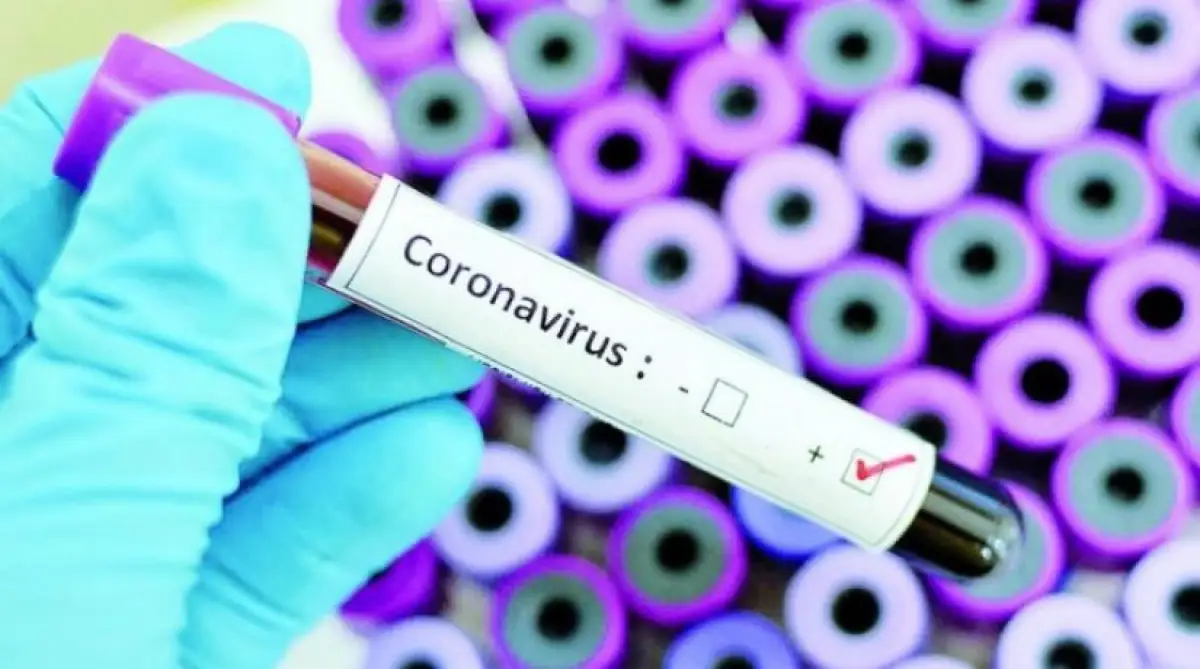 Ситуация с коронавирусом в Казахстан - онлайн-брифинг Минздрава РК