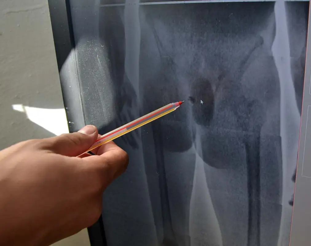 В Караганде осужденный пытался пронести в прямой кишке телефон и наркотики