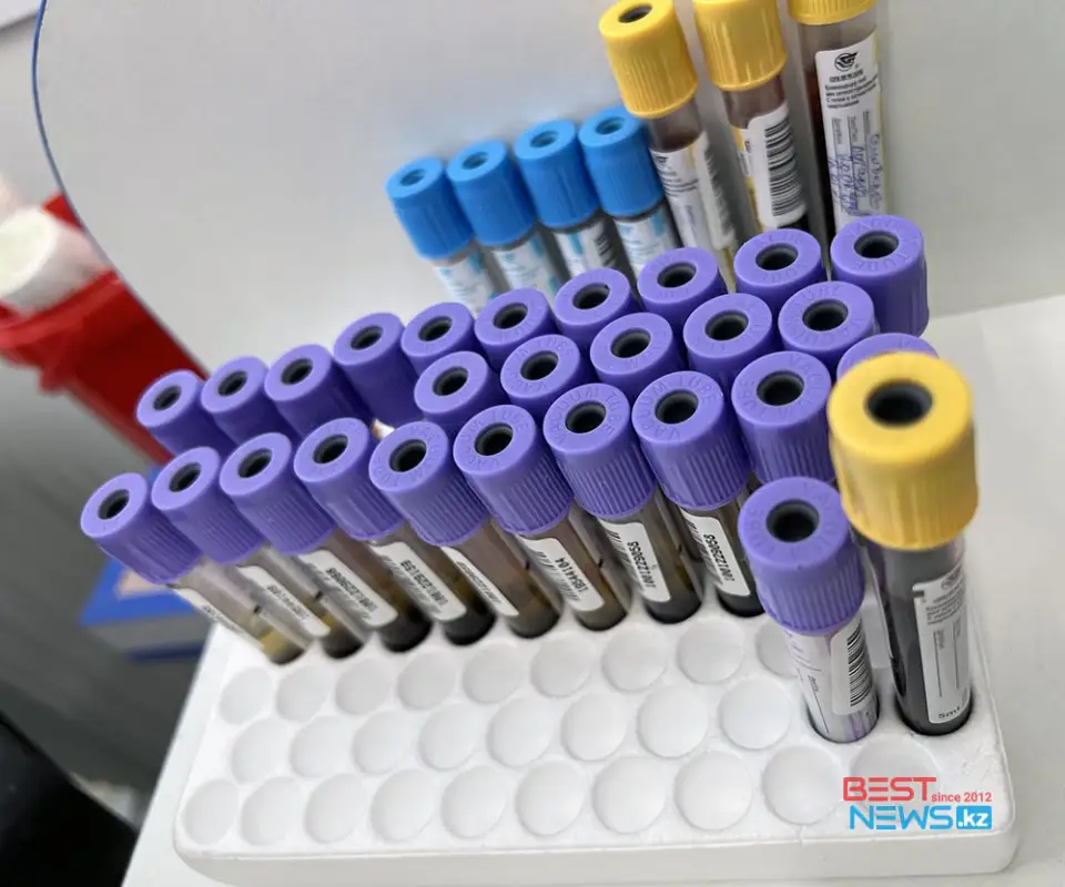 За сутки в Казахстане выявили 10,4 тысячи случаев коронавируса