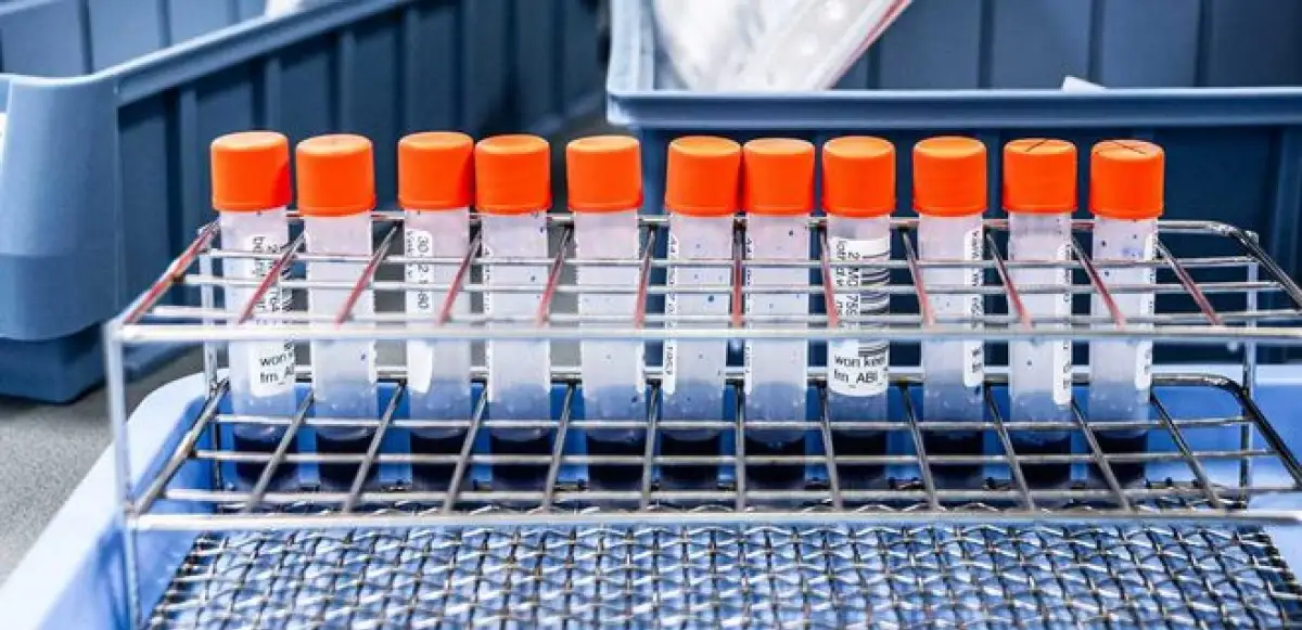 В Кызылординской области число пациентов с коронавирусом достигло 85