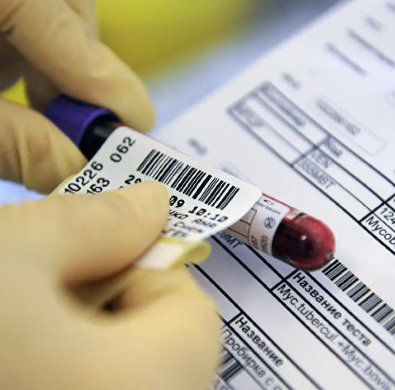 Зарегистрированы еще 17 случаев заражения коронавирусом в РК