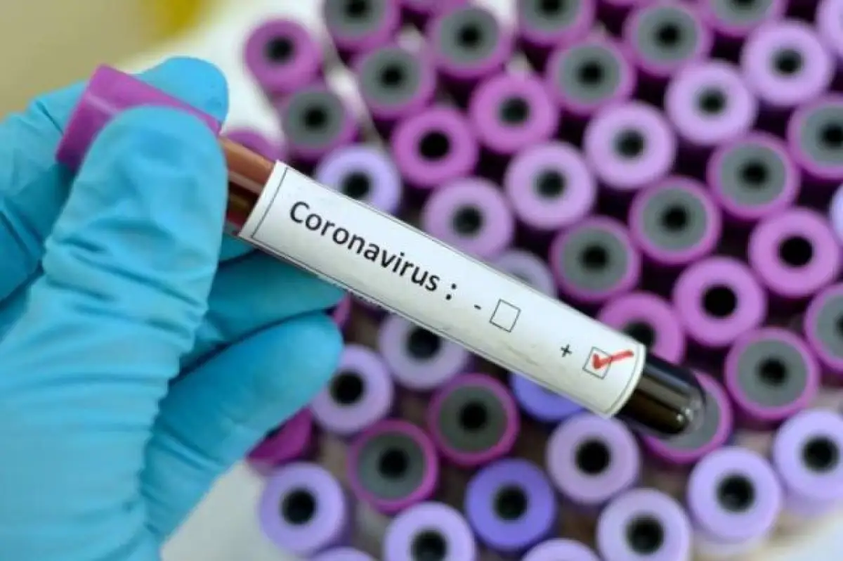 Зарегистрировано еще 23 новых случая заражения коронавирусом в РК