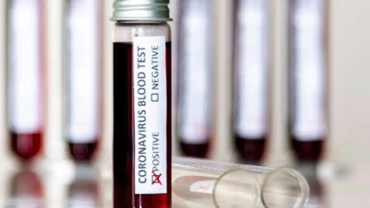 Как сразу 19 человек в Акмолинской области заразились от одного источника 