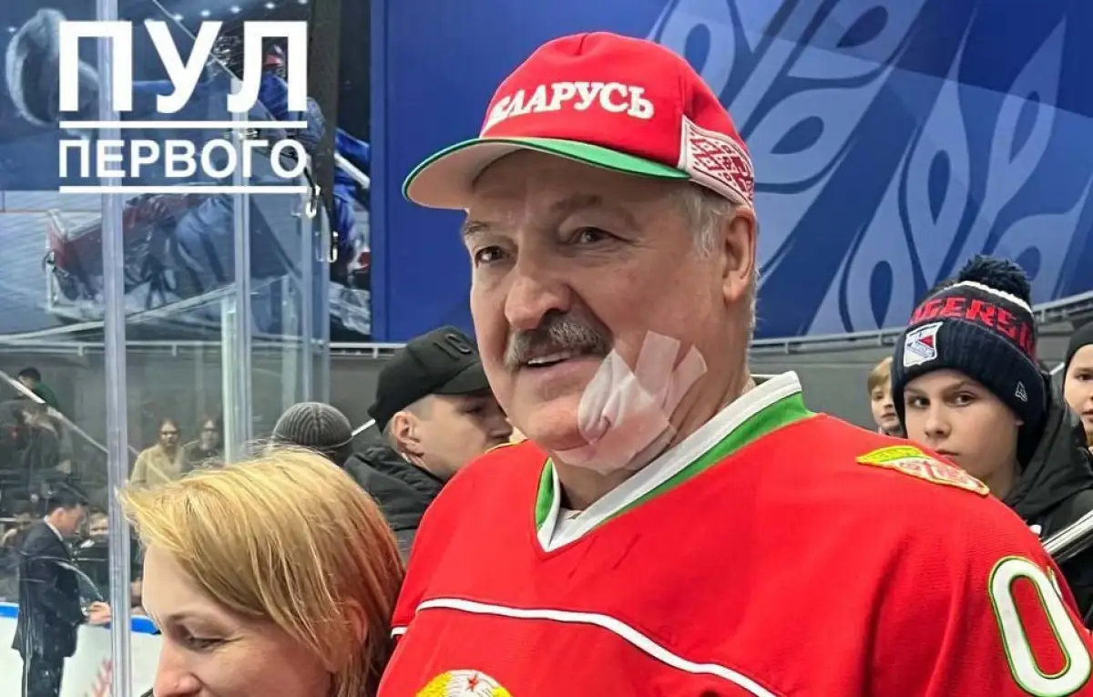 Лукашенко ударили клюшкой по лицу - видео