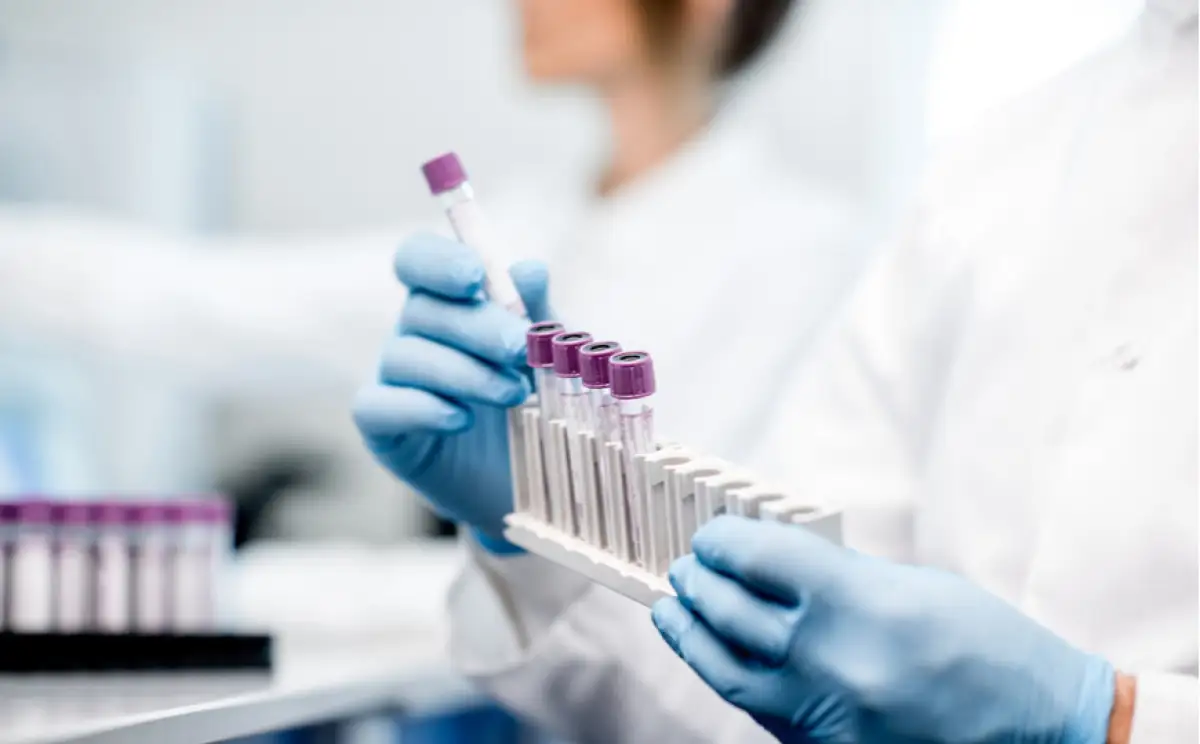 COVID19: в Казахстане увеличат число мобильных лабораторий