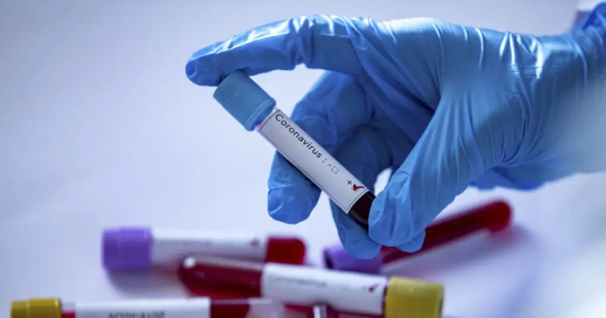 2 новых случая заражения коронавирусом в Алматинской области