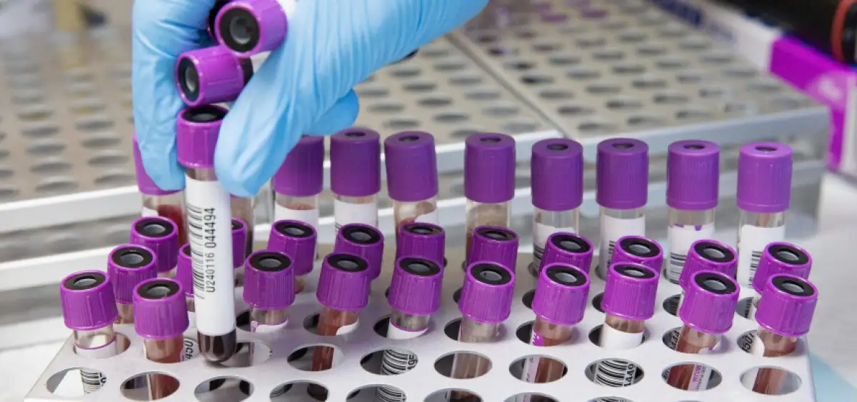 В Казахстане число пациентов с коронавирусом превысило 19000