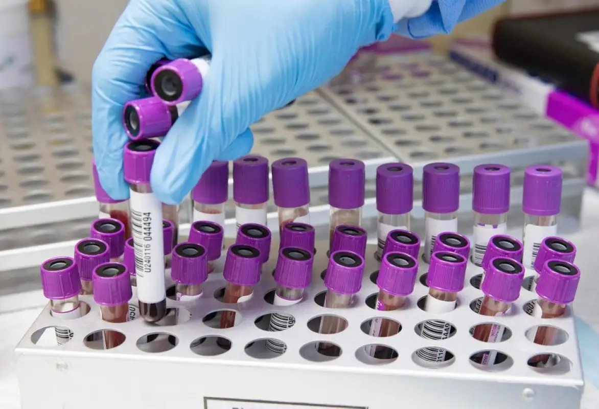 В Казахстане выявили 1069 заболевших коронавирусом 