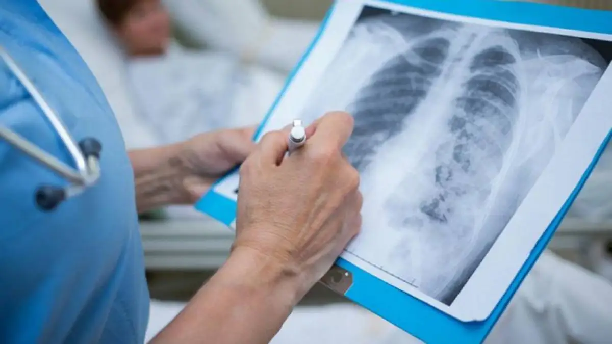 В Казахстане 52 человека заболели пневмонией с признаками коронавируса