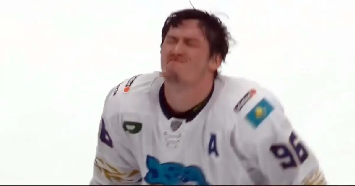 Стало известно о состоянии Асетова после сильного удара клюшкой в лицо