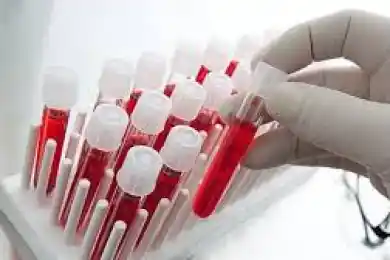 Число зараженных COVID19 в Казахстане достигло 1202