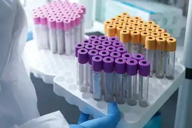 За сутки 465 казахстанцев заболели коронавирусом 