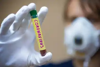 Два случая заражения COVID19 выявлены в Жамбылской и Северо-Казахстанской областях