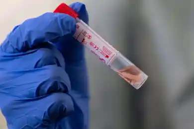 Два новых случая в Алматы с COVID19, по Казахстану - теперь 137 пациентов