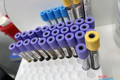 За сутки в Казахстане выявили 253 случая коронавируса, всего в стране 1,3 млн заболевших