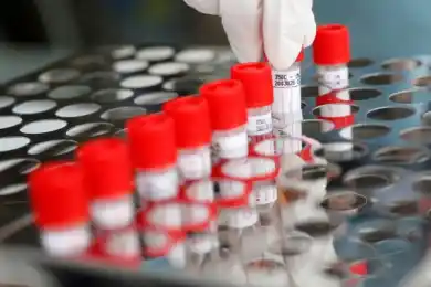 Павлодарская область не уступает: где выявили наибольшее число коронавируса за 24 часа