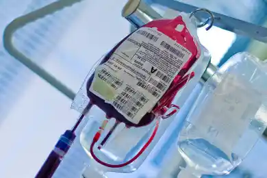 В Казахстане нет переливания плазмы зараженным пациентам с COVID19