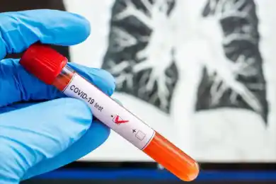 В Казахстане 21 пациент с COVID находится в тяжелом состоянии