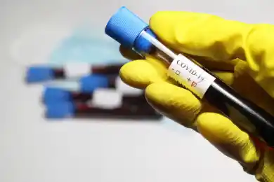 В Казахстане за сутки выявили 112 больных с коронавирусом