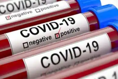 За сутки в Казахстане выявили 714 случаев коронавируса