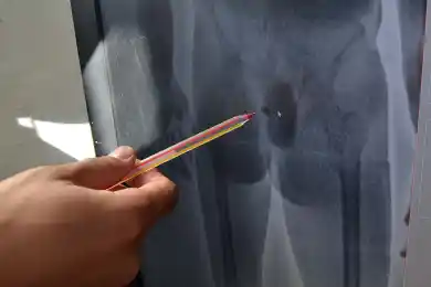 В Караганде осужденный пытался пронести в прямой кишке телефон и наркотики