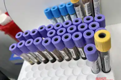 За сутки в Казахстане выявили 10,4 тысячи случаев коронавируса