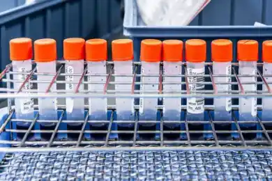 В Кызылординской области число пациентов с коронавирусом достигло 85