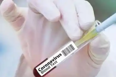 Почему отменили ПЦР-тесты для авиапассажиров в Казахстане. Ответ Тугжанова