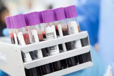 В РК выявили 40 новых пациентов с COVID19