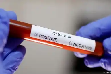 Когда жители Нур-Султана смогут сдать тесты на коронавирус