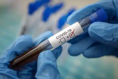 У близких скончавшегося астанчанина диагностировали коронавирус