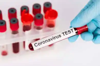 В РК 138 человек заразились коронавирусом, из них в Атырауской области - 92 