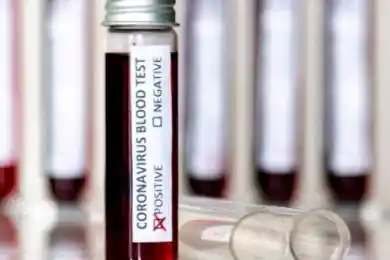 Как сразу 19 человек в Акмолинской области заразились от одного источника 