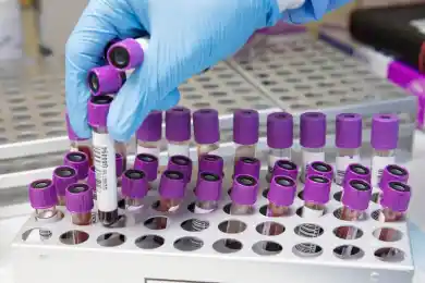 В Казахстане выявили 1069 заболевших коронавирусом 