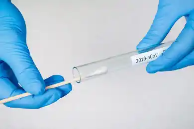 В Казахстане подешевели ПЦР-тесты, но одна из лабораторий ждёт погашения долгов государства и встречных шагов