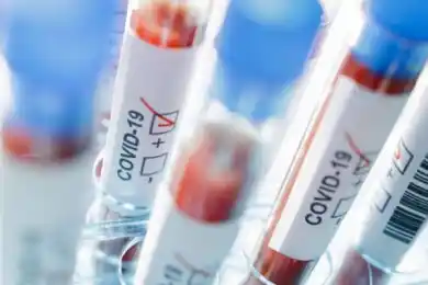 В Алматы выявлен новый пациент с COVID-19