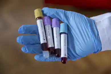 В Нур-Султане и Алматы выявили по 500 случаев ковида за сутки