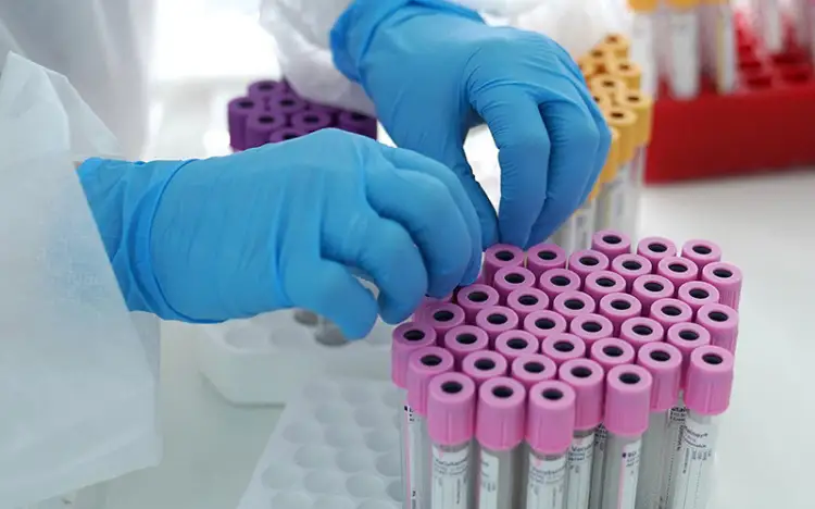 За сутки в Казахстане коронавирусом заболели 1674 человека