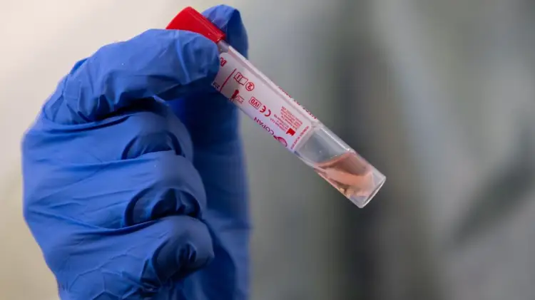 Два новых случая в Алматы с COVID19, по Казахстану - теперь 137 пациентов