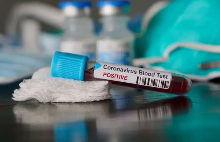 Сауле Кисикова: «Порядка 3000 жителей Нур-Султана уже прошли экспресс-тесты на коронавирус»