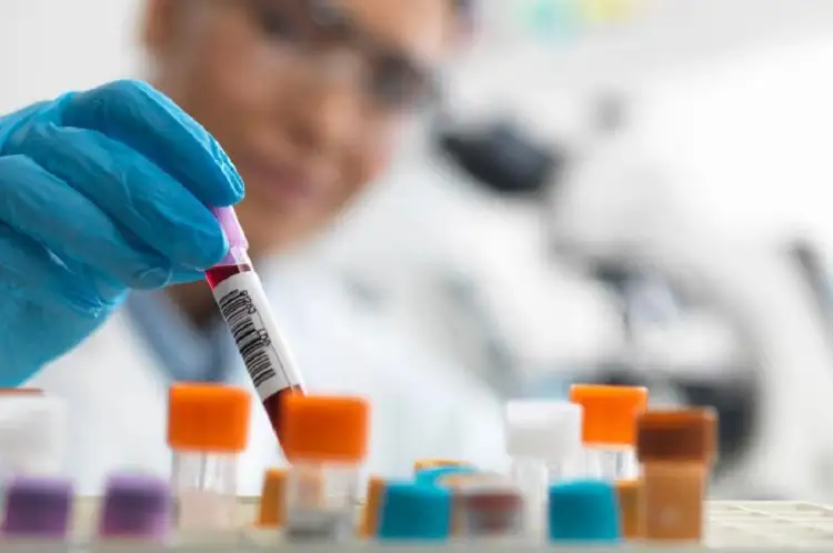 Еще 32 зараженных COVID19 выявили в Казахстане