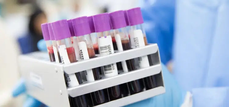 В РК выявили 40 новых пациентов с COVID19