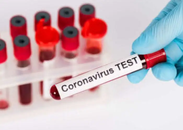 За сутки в Казахстане выявили 757 случаев ковида