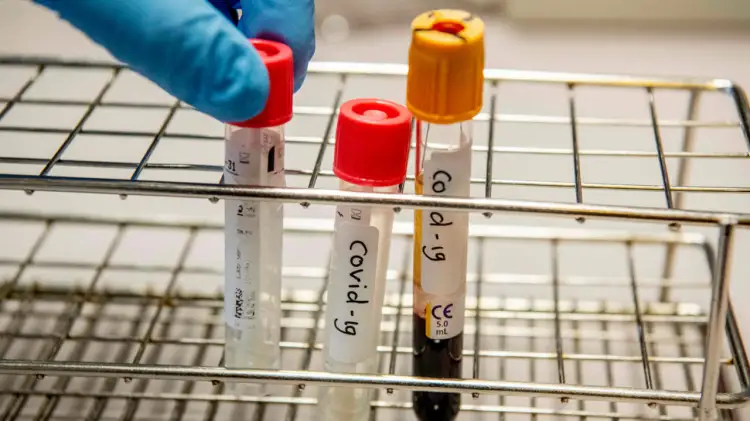 Зарегистрирован 21 пациент с коронавирусом в Казахстане